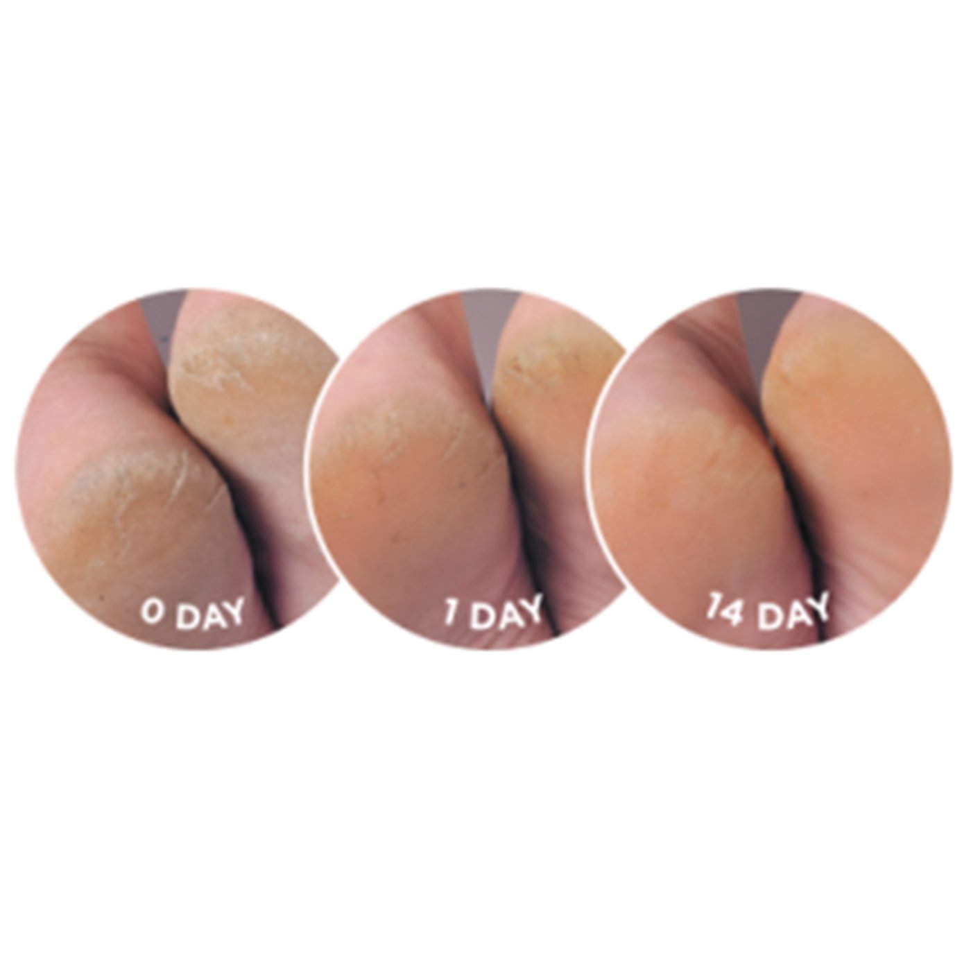 Dermal Therapy Heel Balm Platinum 75g