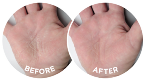 Dermal Therapy Hand Balm 50g