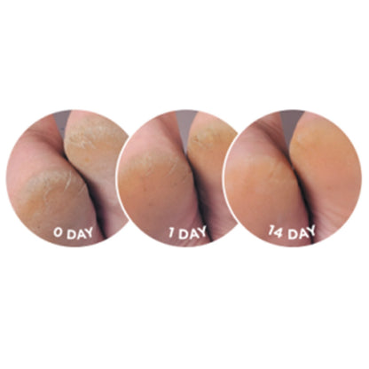 Dermal Therapy Heel Balm Platinum 75g